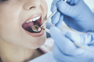 woman about to have a tooth extraction