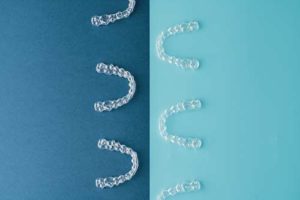 examples of clear aligners