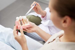 a woman holds a model of dental implants