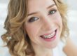 adult female patient with dental braces