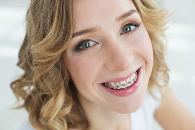 adult female patient with dental braces
